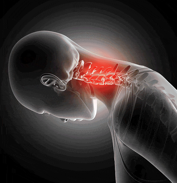 nek kussen cervicale, ergonomisch nek kussen cervicale ondersteuning, traagschuim nek kussen cervicale, beste nek kussen cervicale pijn, contour nek kussen cervicale rugslaper
